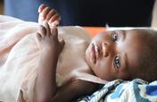 Nutrition for Children in Cancer Ward in Tanzania