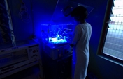 Treating Babies with Severe Jaundice in India