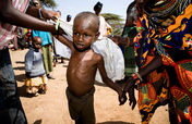 East Africa Drought Crisis