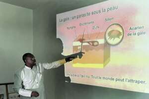 Dr. Mane explains scabies and its treatment