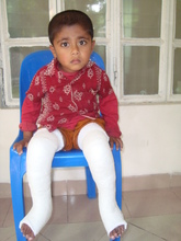 Ashik (post treatment)