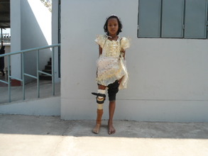 Kohinur (post treatment)