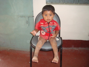 Nahid (pre treatment)