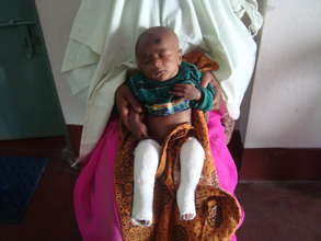 Polash (post treatment)