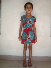 Urmi (pre treatment)