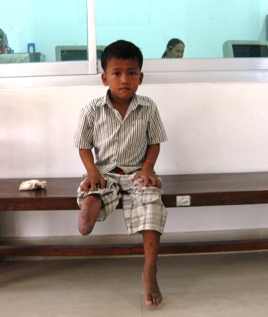 Give 40 Children in Asia the Ability to Walk!