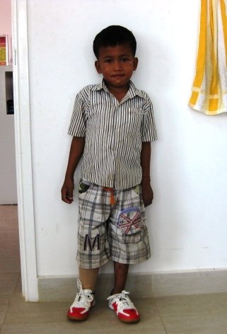 Give 40 Children in Asia the Ability to Walk!