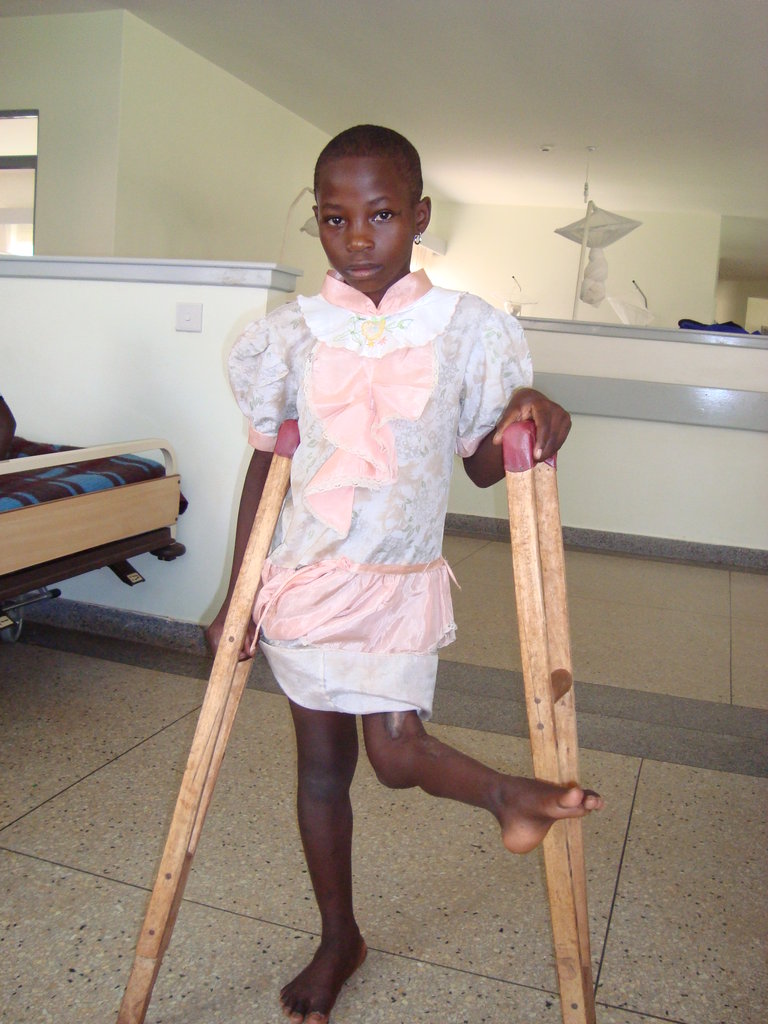 Give 40 Children in Asia the Ability to Walk!