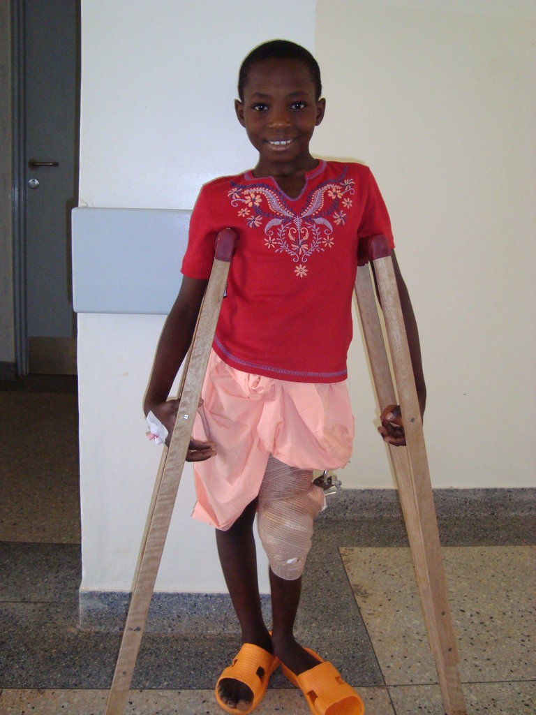 Give 40 Children in Asia the Ability to Walk!