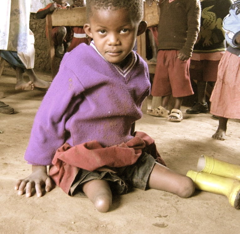 Give 40 Children in Asia the Ability to Walk!