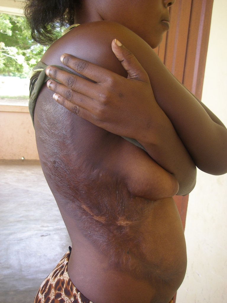 Assist 38 ex-child slaves in  Ghana for training