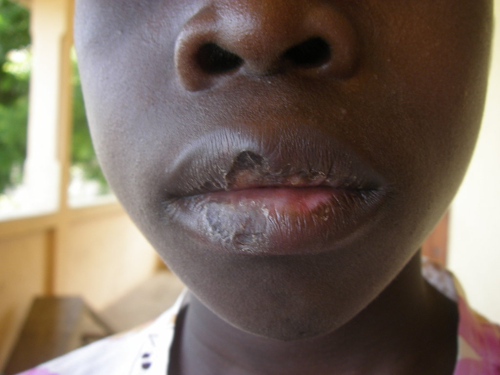 Assist 38 ex-child slaves in  Ghana for training