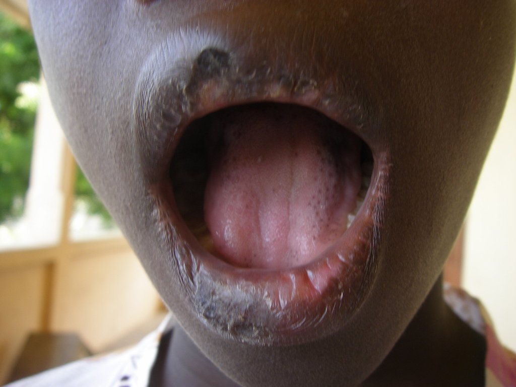 Assist 38 ex-child slaves in  Ghana for training