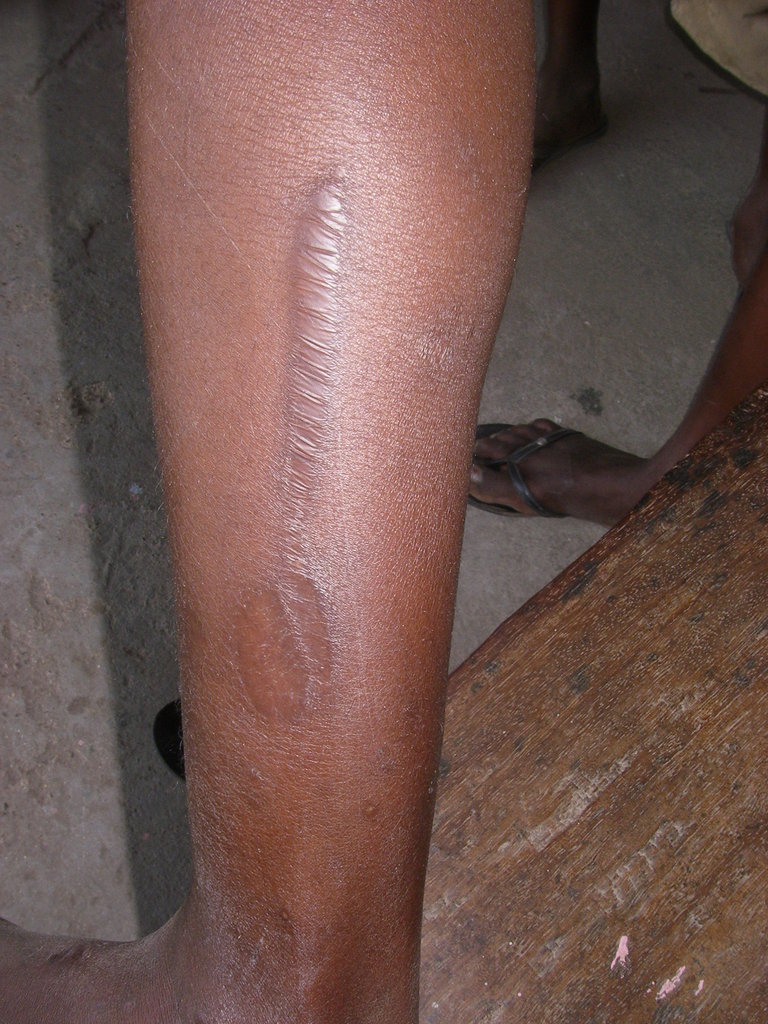 Assist 38 ex-child slaves in  Ghana for training