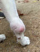 The mass on her leg that needs to be removed