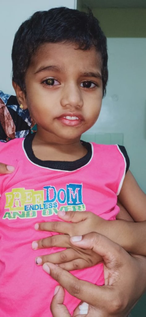 Baby Athlin from Kerala, eye cancer patient