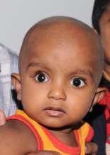Two-year-old Rohit at Aravind's Cancer Center