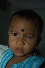 Retinoblastoma patient