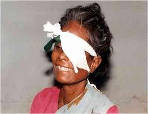 Give the Gift of Sight to the poor in India