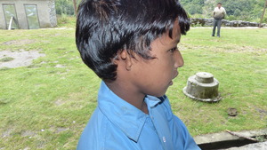 Manoj Ram of Wacham with unformed ear.