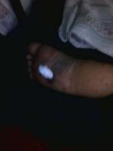 shafic's leg