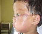 ...corrected with surgery