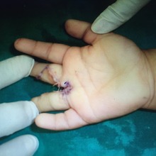 Akish After