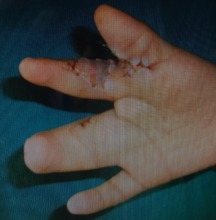 Left Hand After