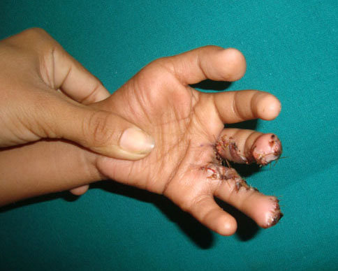 Heal children's lives with corrective surgery