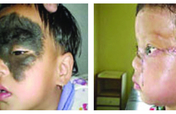Heal children's lives with corrective surgery