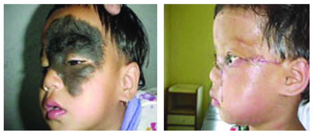 Heal children's lives with corrective surgery