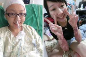 Hui-Chu was hospitalized for a long time