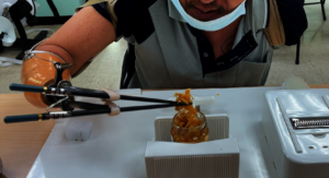 Special chopsticks for bilateral amputee