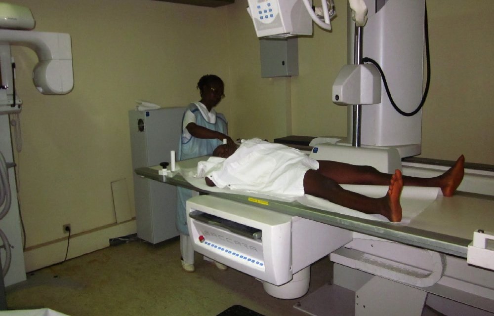 Surgery for Ruphat and 3 other boys in Cameroon