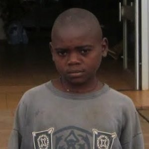 Surgery for Ruphat and 3 other boys in Cameroon