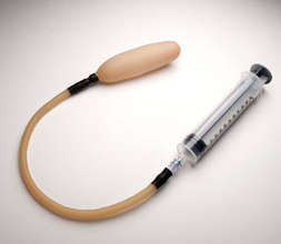A prototype of the uterine balloon tamponade.