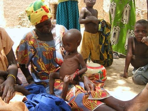 Fight child hunger in Niger