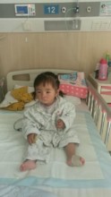 Ze Xuan after her operation.