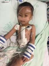 One of 33 children whose life was saved.
