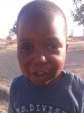 This is Andrew Dube, with his new prosthetic eye