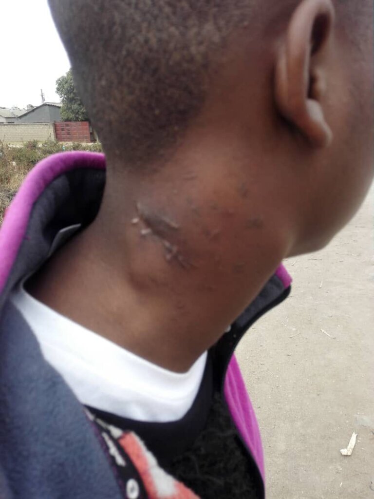 Save the lives of children with cancer in Zimbabwe