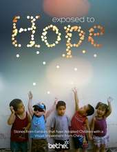 Exposed to Hope book cover