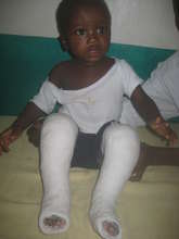 Amos get his first casts