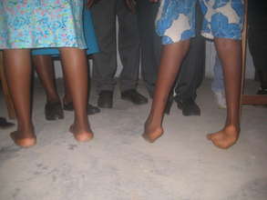 A comparison of normal vs. clubfoot heel