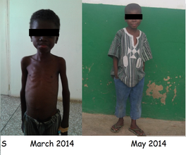 S's progress since starting the program!