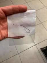 The thread gotten out of Charlie's neck.