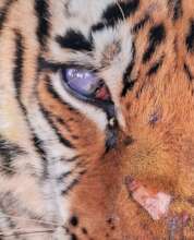 Permanent damage to the right eye