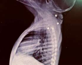 Tsotsi's body was peppered with gunshot pellets
