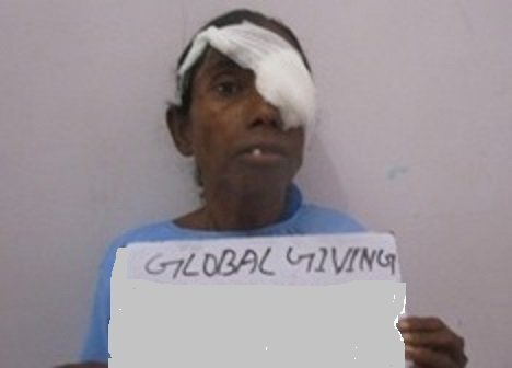 After Surgery
