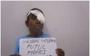 Putul after operation